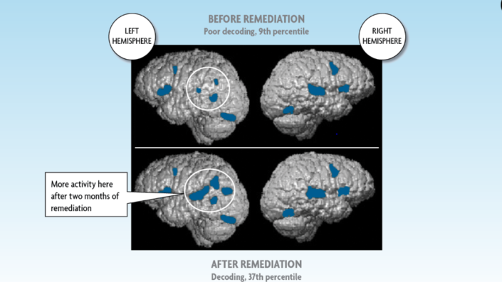 Infographics – Learn71